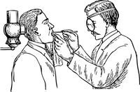 лечение на гранулом - 77268 възможности